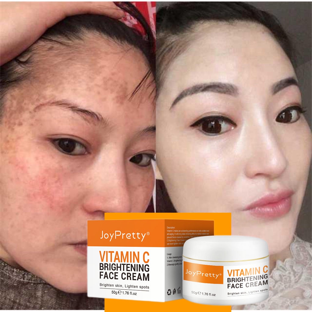 KRIM VITAMIN C PENGHILANG BINTIK HITAM Lulur pemutih badan Cream pemutih wajah Pelembab wajah Krim Malam Vitamin c  Meremajakan &amp; Mencerahkan Kulit