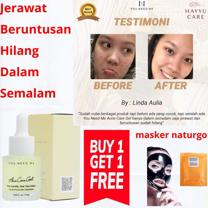 You Need Me Serum Skincare Perawatan Wajah Penghilang Jerawat Flek Hitam Bopeng Beruntus Cepat Ampuh