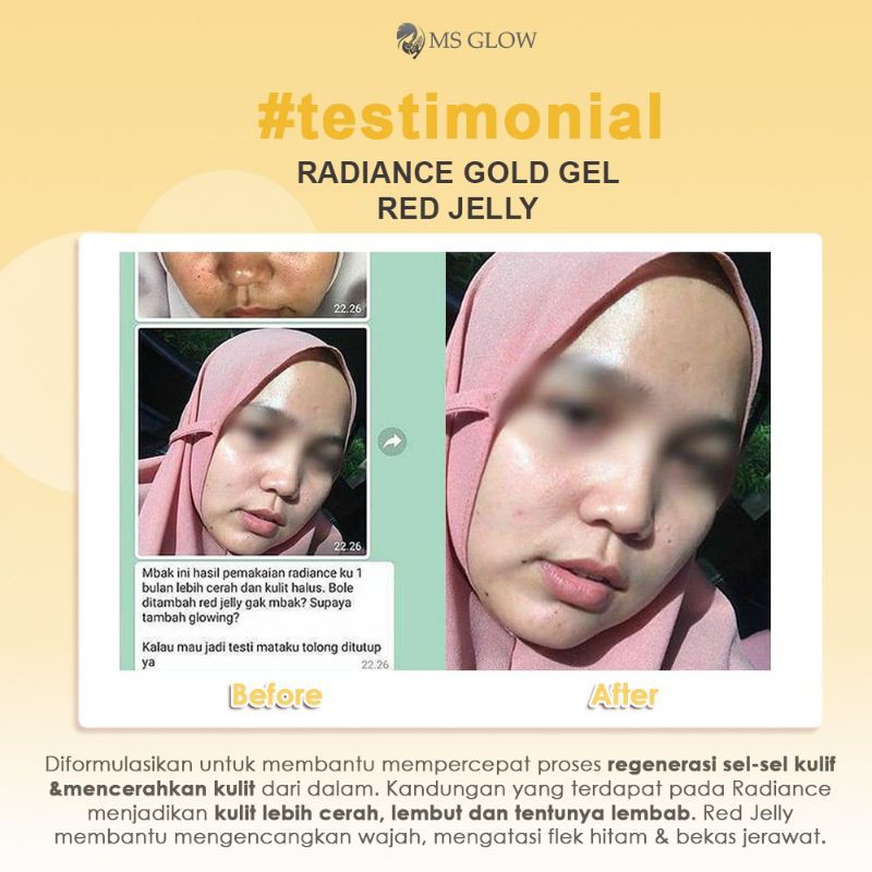 Radiance Gold Gel MS Glow / Mempercepat putih wajah / Gold Gel / Produk Terlaris / Original