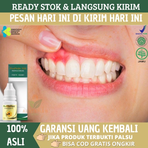 Obat Gusi Bengkak, Obat Sakit Gusi, Obat Gusi Bengkak Bernanah, Obat Gusi Bengkak dan Sakit, Obat Gu