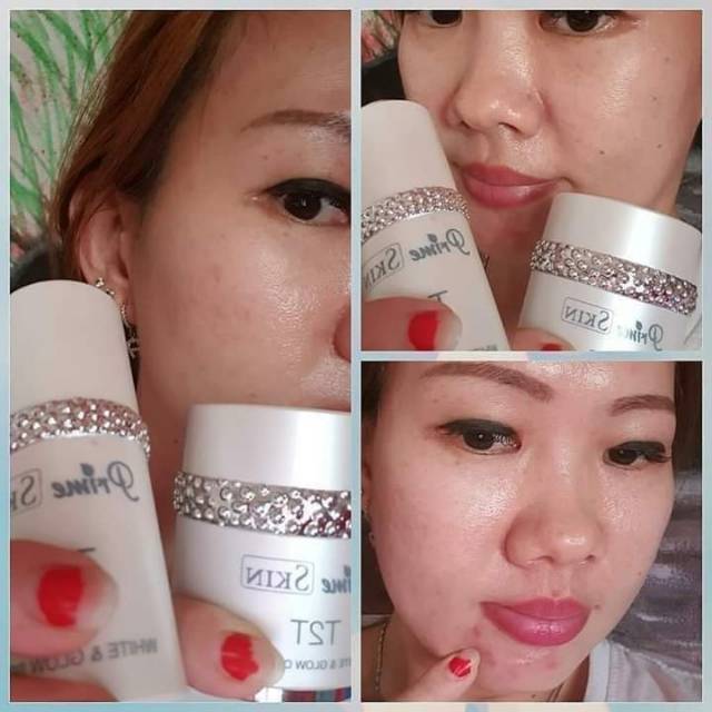 T2T cream dan serum HWI