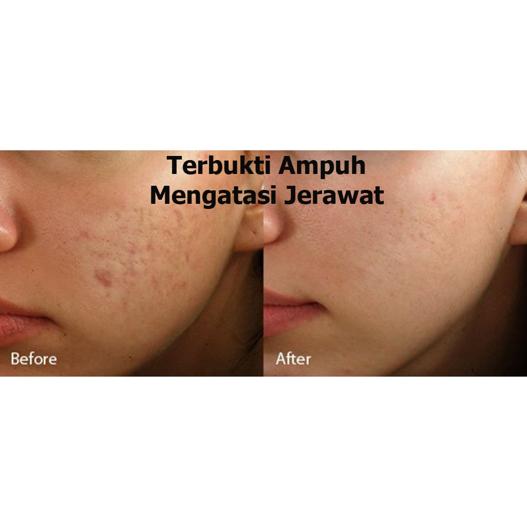 Khasiat Dan Manfaat Qnc Jelly Gamat Untuk Kecantikan Masker Teripang Emas Alami Indonesia