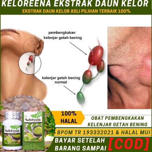 Obat Kelenjar Getah Bening Bengkak, Pembengkakan Kelenjar Getah Bening, Di Leher, Di  Ketiak, Belaka