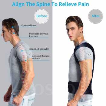 Back Posture Corrector Penyangga Tulang Belakang Penegak Punggung - S