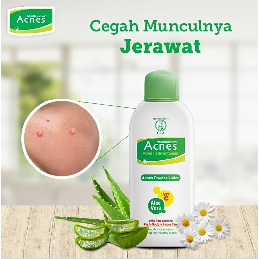 ACNES Starter Pack - Paket Perawatan Wajah Berjerawat