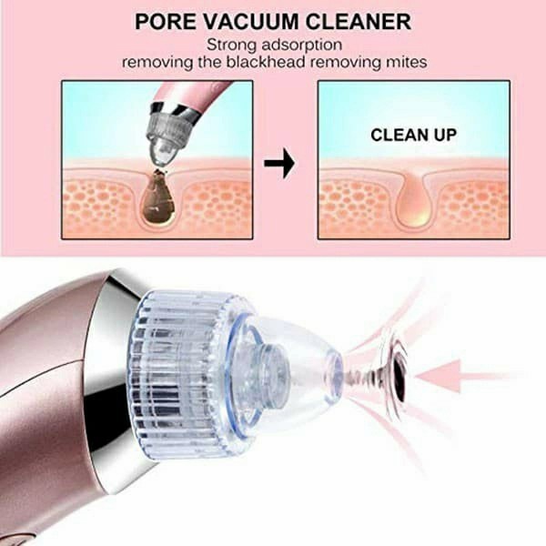 XN-8030 Vacum Comedo Cleaner Alat Penyedot Komedo Grosir