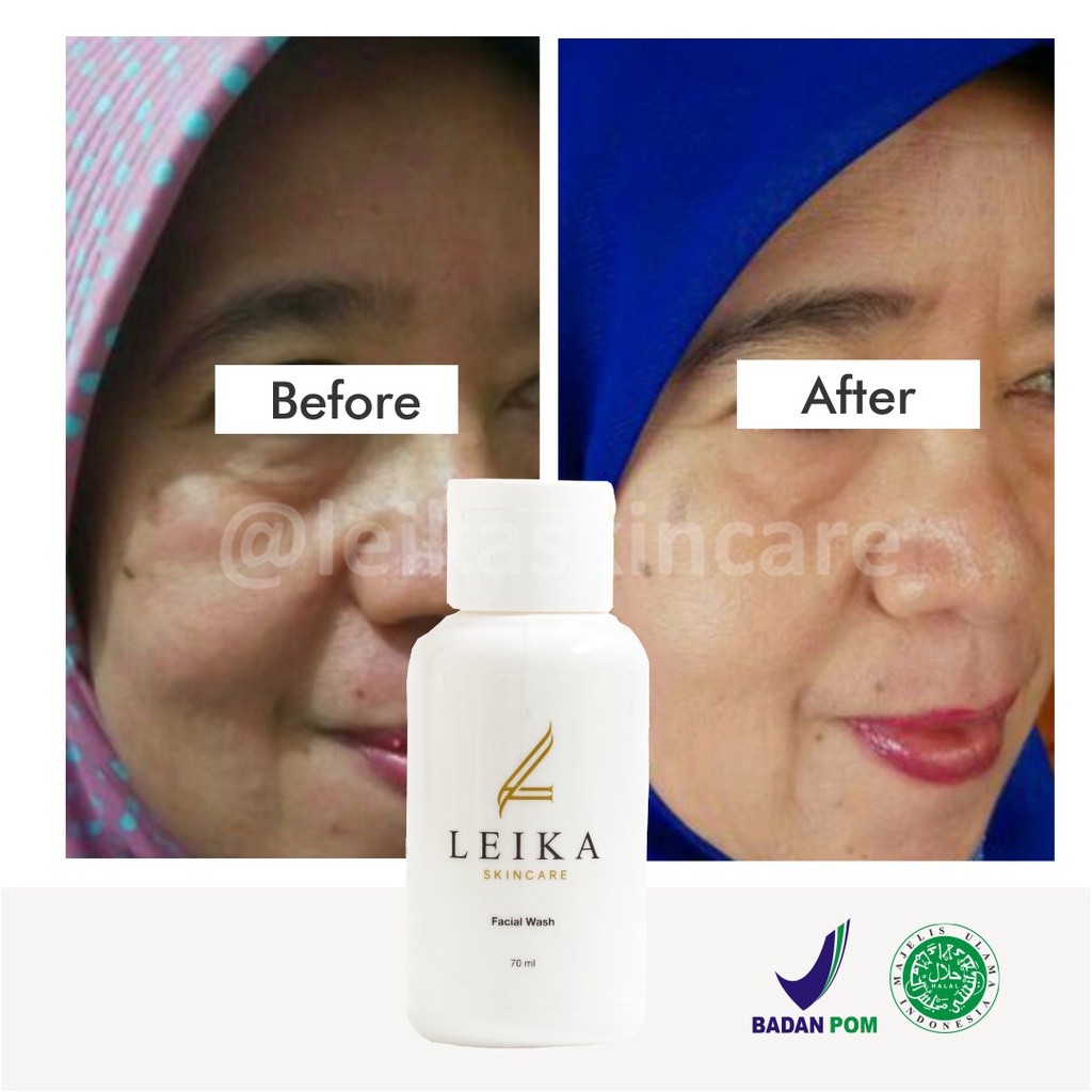 Wow! Sabun Muka Anti Aging Paling Ampuh Sabun Anti Penuaan Dini Asli Halal BPOM Facial Wash Leika Skincare 70ml Sabun Penghilang Kerutan di Wajah Original