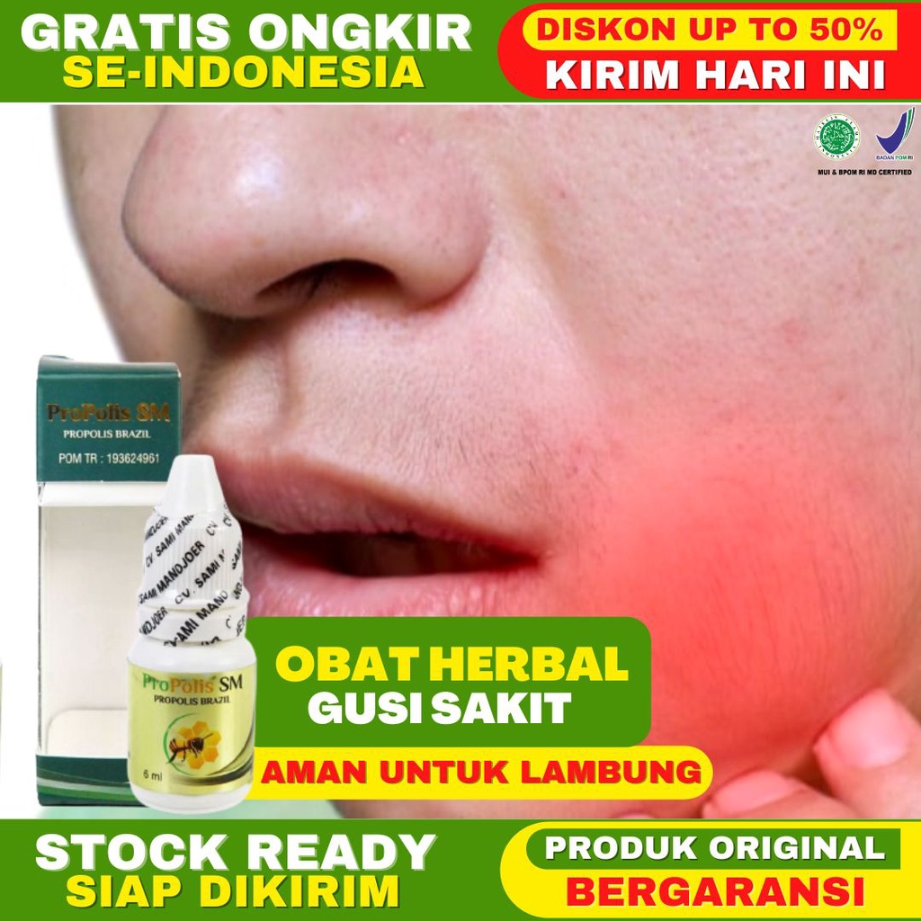 Obat Gusi Sakit Obat Sakit Gigi Obat Sakit Gigi Berlubang Obat Gusi Bengkak Obat Bau Mulut Obat Gusi