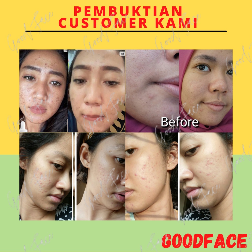 SERUM WAJAH PEMUTIH WAJAH GLOWING SOMETHINC SKIN DEFENDER BAKUCHIOL + COQ10m PERAWATAN WAJAH