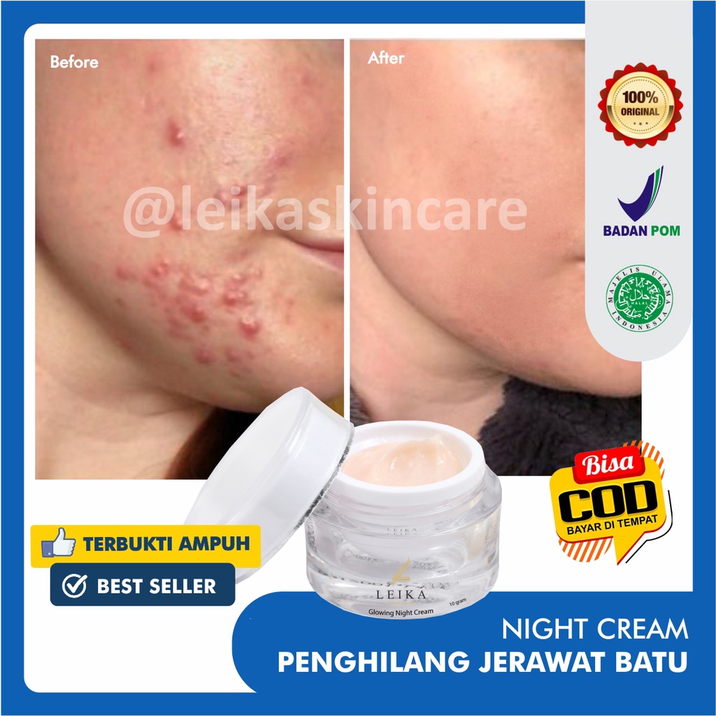 Cream Penghilang Jerawat Penghilang Bekas Jerawat Ampuh! Obat Jerawat dan Bekas Jerawat Obat Jerawat Paling Ampuh untuk Wanita Penghilang Jerawat dan Bekas Jerawat Glowing Night Cream Leika Skincare Resmi BPOM cream wajah berminyak dan berjerawat