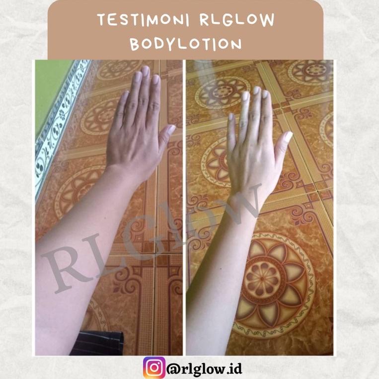 F-EAQ} ✪} RL GLOW BODY LOTION PEMUTIH BADAN AMPUH MEMUTIHKAN KULIT /MEMUDARKAN BEKAS LUKA / MEMUDARK