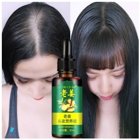 OBAT PENUMBUH RAMBUT CEPAT ANTI RONTOK MENGATASI BOTAK SERUM RAMBUT JAHE-SERUM 7 DAY 30 ML
