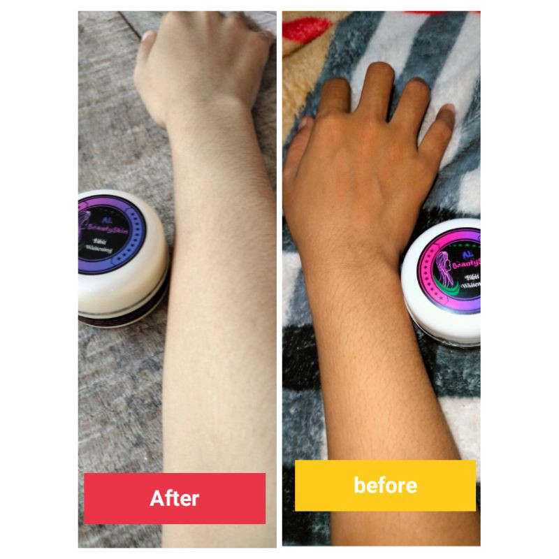 AL BeautySkin Bibit Whiteng
