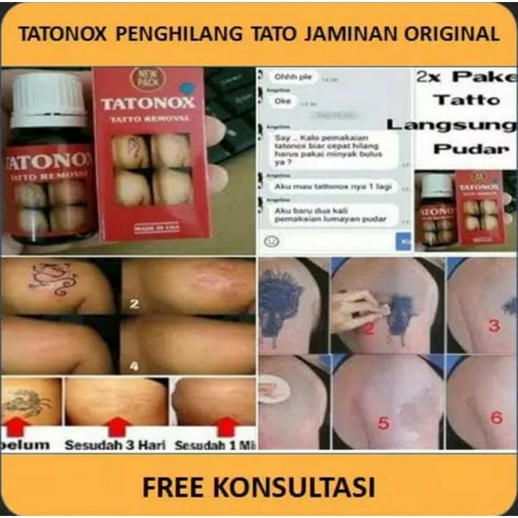 Tattonox Tatonox Ori Original Tatonok Obat Penghilang Penghapus Tato Tatto Asli Permanen Permanen ab