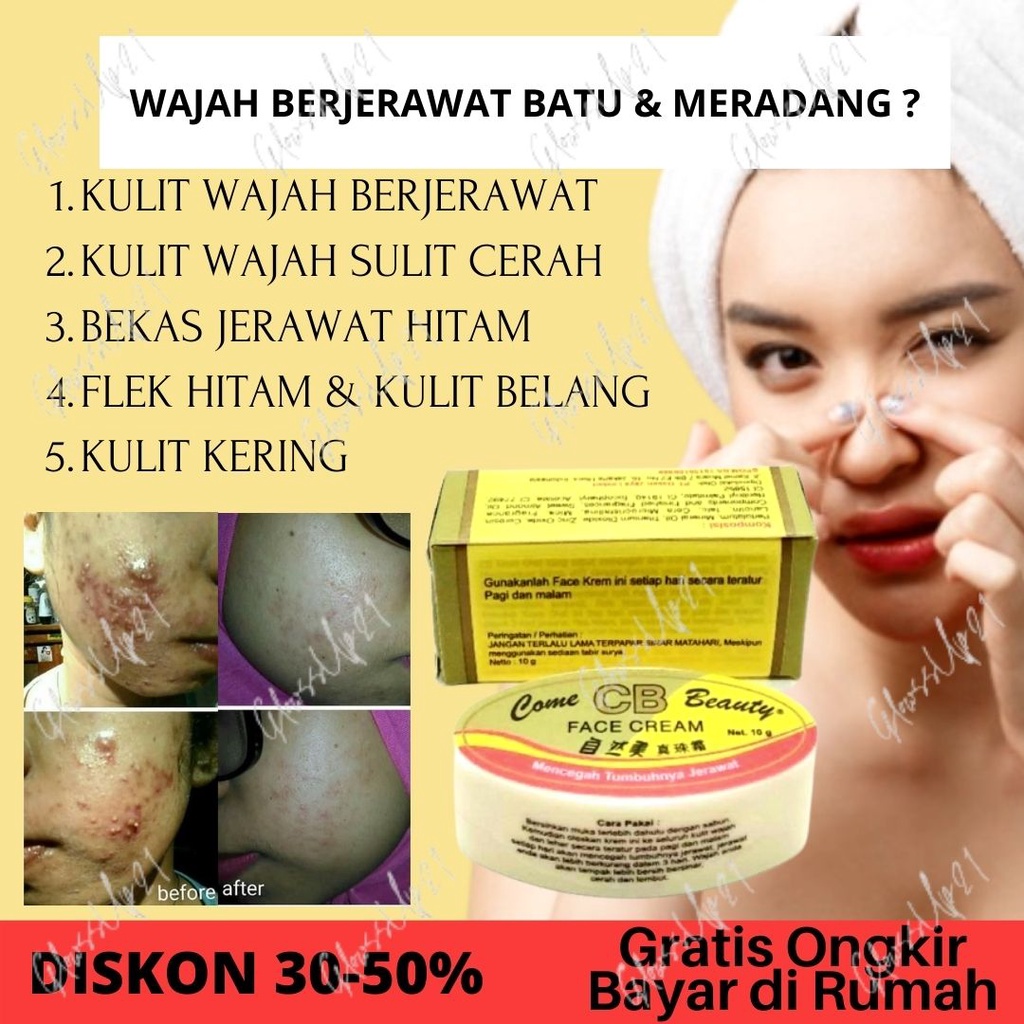 CREAM PENCERAH WAJAH KRIM PEMUTIH WAJAH PENGHILANG FLEK JERAWAT - CB CREAM KOREA ORIGINAL