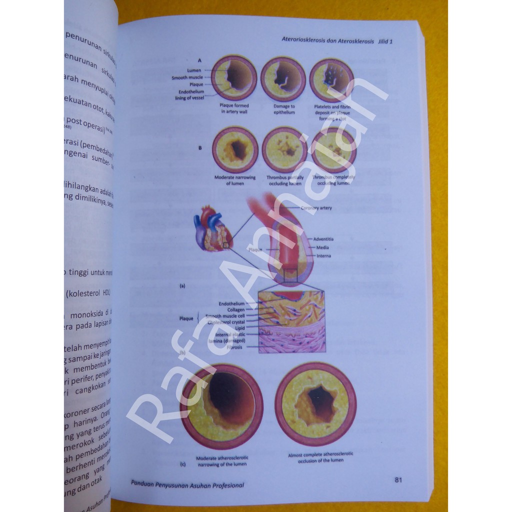 PROMO Aplikasi NANDA NIC NOC Edisi Revisi 2015 (3 Jilid) Berwarna LIMITED