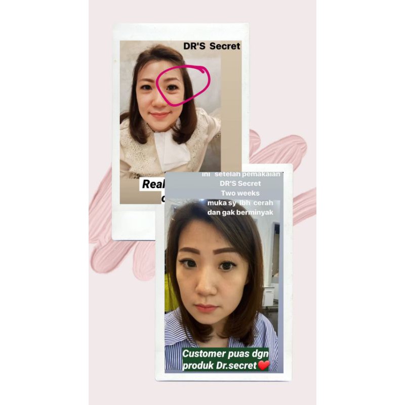 SKIN CARE DR'S SECRET AESTIER EYE CREAM