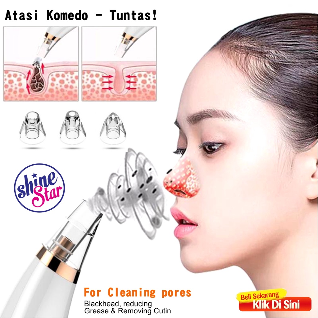 SHINE STAR - BISA COD - Alat Penyedot Komedo dan Jerawat - Vakum Komedo /Alat Komedo Facial /Alat Sedot Komedo