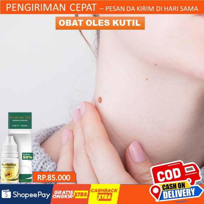 OBAT KUTIL - OBAT KUTIL KELAMIN - OBAT KUTIL DI LEHER - OBAT KUTIL DI WAJAH - OBAT KUTIL DI TANGAN