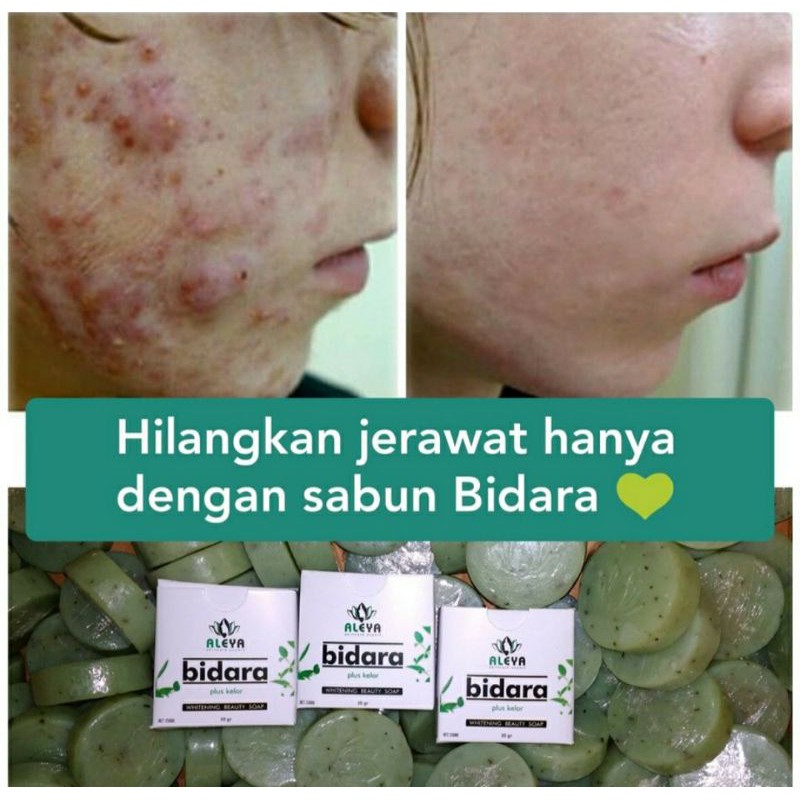 Sabun Bidara plus kelor