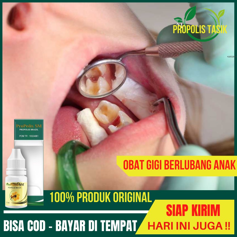 Obat Sakit Gigi Untuk Anak Anak Dewasa Ibu Hamil dan Ibu Menyusui PROPOLIS SM