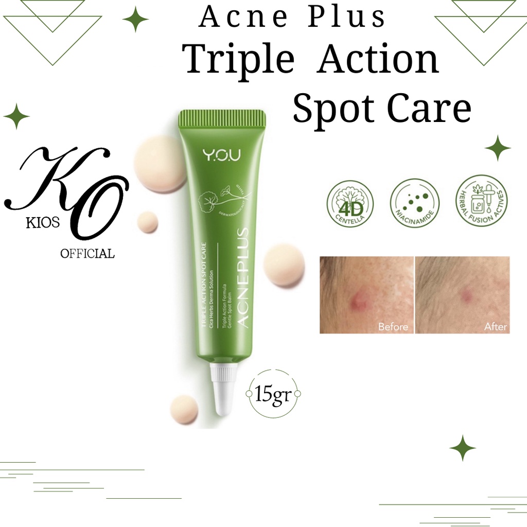 You Acne Plus Triple Action Spot Care 15gr