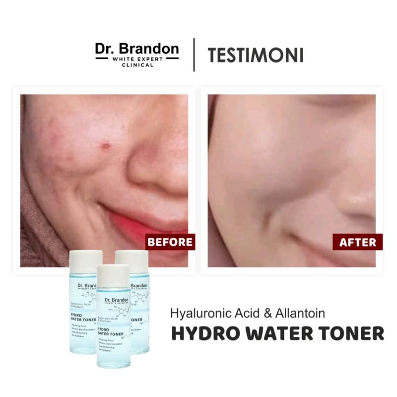 Dr. Brandon HYDRO WATER TONER (With Hyaluronic Acid &amp; Allantoin) 60ml