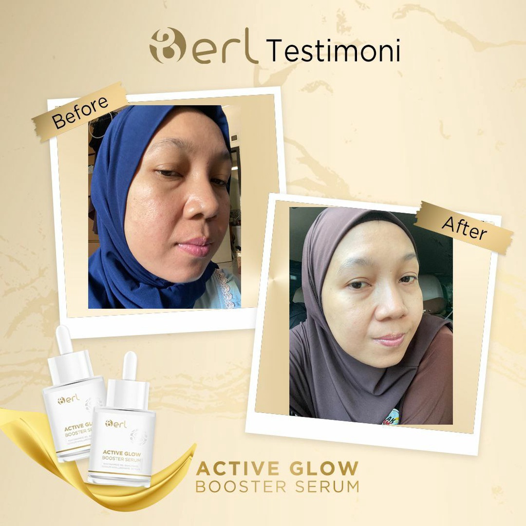 B ERL Active Glow Booster Serum | B ERL Cosmetics Pre Serum | Memperkuat Skin Barrier | Mencerahkan &amp; Melembabkan Kulit