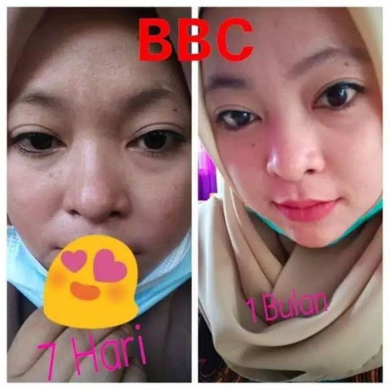 Bebwhite c skincare/bbc/bebwhite