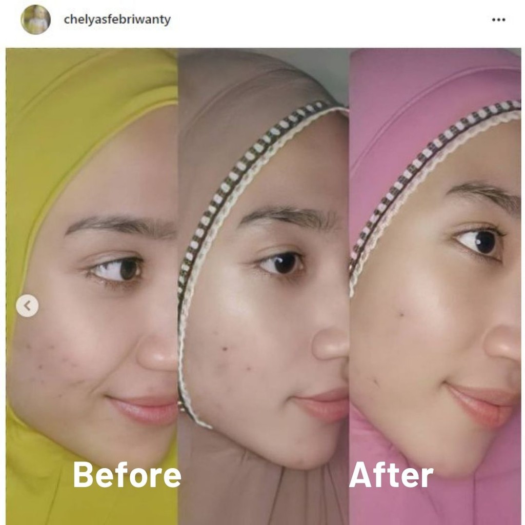 Skin Glow Serum Pratista - Serum Glowing BPOM - Ahlinya Menjadikan Wajah Glowing