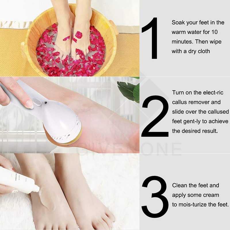 MISS ROSE Alat Perawatan Telapak Kaki Elektrik Menghaluskan telapak kaki Pedicure Care - HF2021 Multifunction Electric Vacuum Adsorption Remove Calluses Hardness Dead Skin Heels Grinding Pedicure Foot Grinder Pedicure