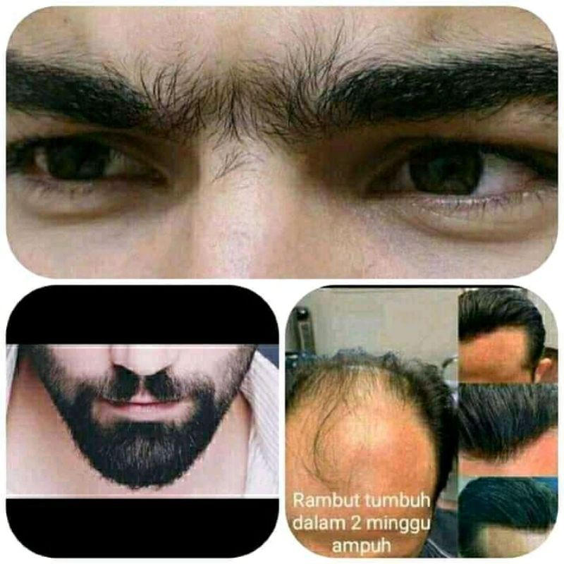 (BAYARDITEMPAT) PENUMBUH RAMBUT DAN BERWOK,ALIS TERBAIK.TIENS ORGINAL|| HERBAL TIENS.