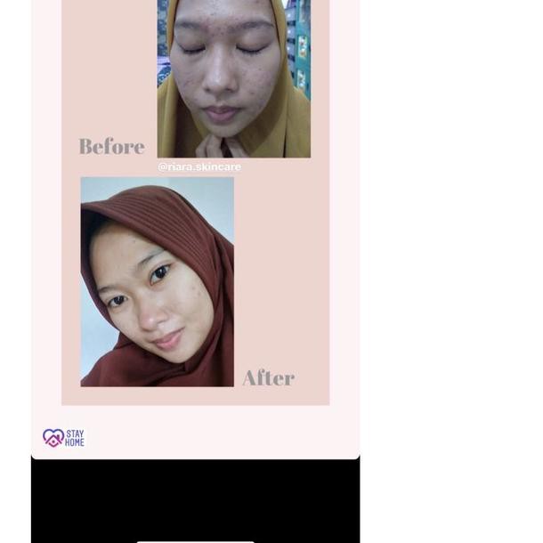 ✮ GRS AND GLOW ➱