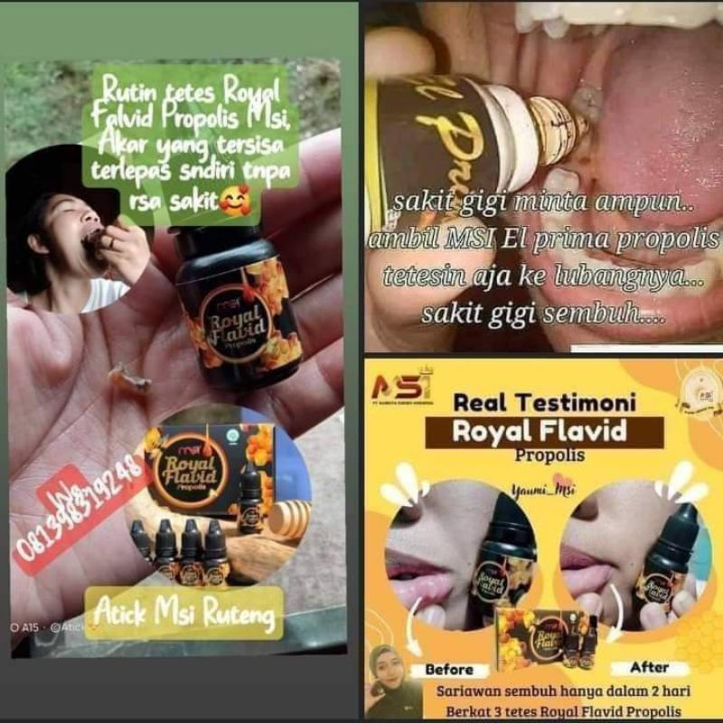 

Royal plafit MSI