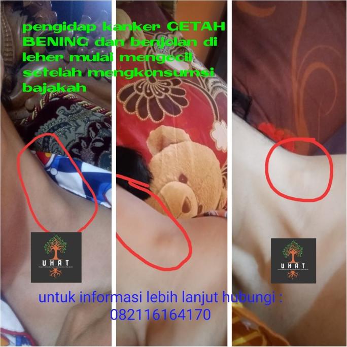 

[ COD ] Teh Bajakah, Teh U H A T Bajakah BERSERTIFIKAT 100% ASLI,isi 30 sachet OBRAL Kode 52