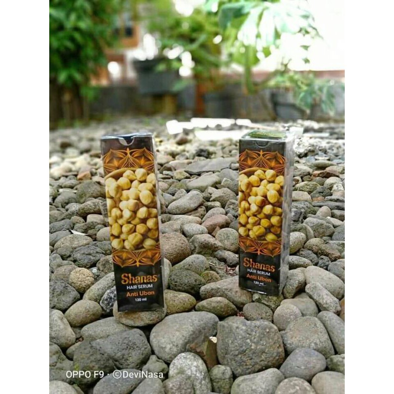 obat uban permanent/penghitam/anti uban/shanas anti uban/anti ketombe