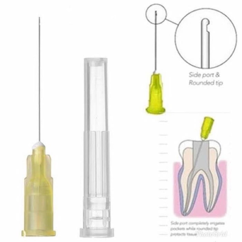 C4.2 dental irigasi tip sidevent 30G/27G