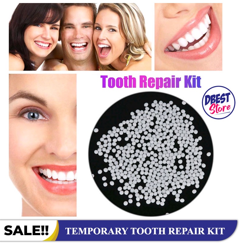 DBEST - [PAKET 50 BUTIR] Gigi Palsu / Temptooth Lem Tambal Gigi Ompong Patah dan Berlubang / Temporary Tooth