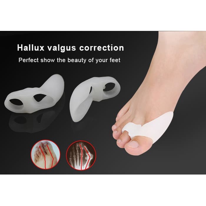 ALAT TERAPI KAKI JEMPOL KAKI HALLUX VALGUS BUNION PEMISAH KOREKTOR JARI KAKI JEMPOL