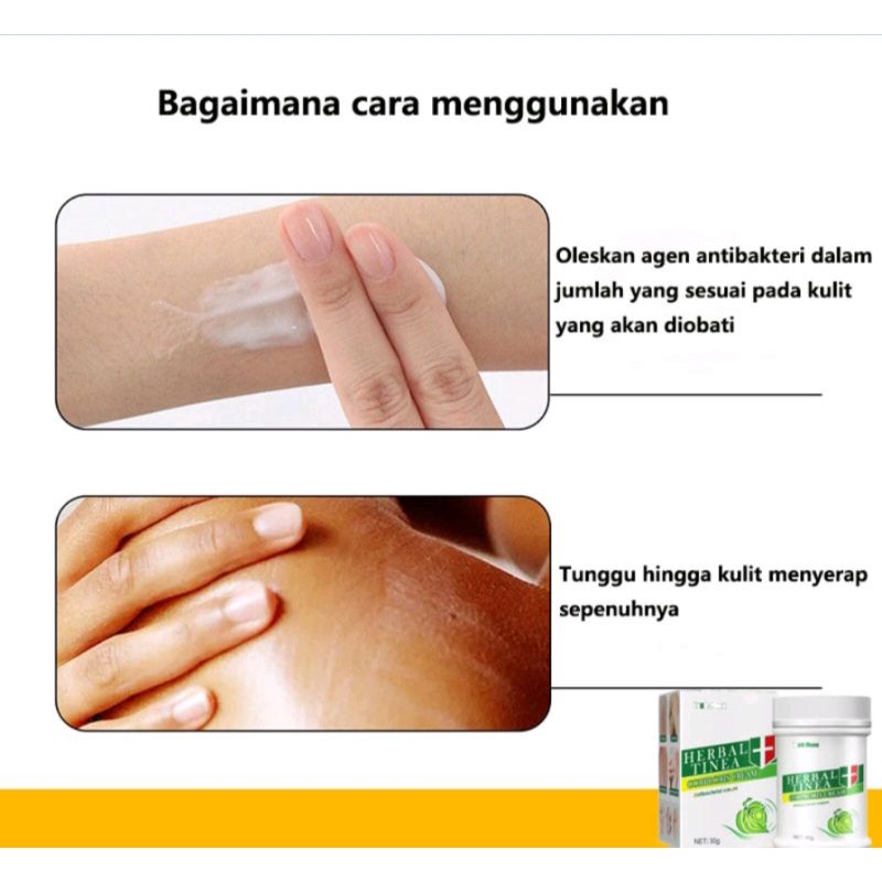 Herbal tinea corproris cream/salep gatal jamur-kudis-kurap-panu dll