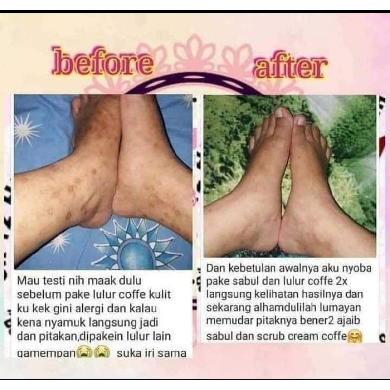 SR12 Body Scrub Kopi Lulur Pemutih Selangkangan Pemutih Badan Penghilang Daki BPOM