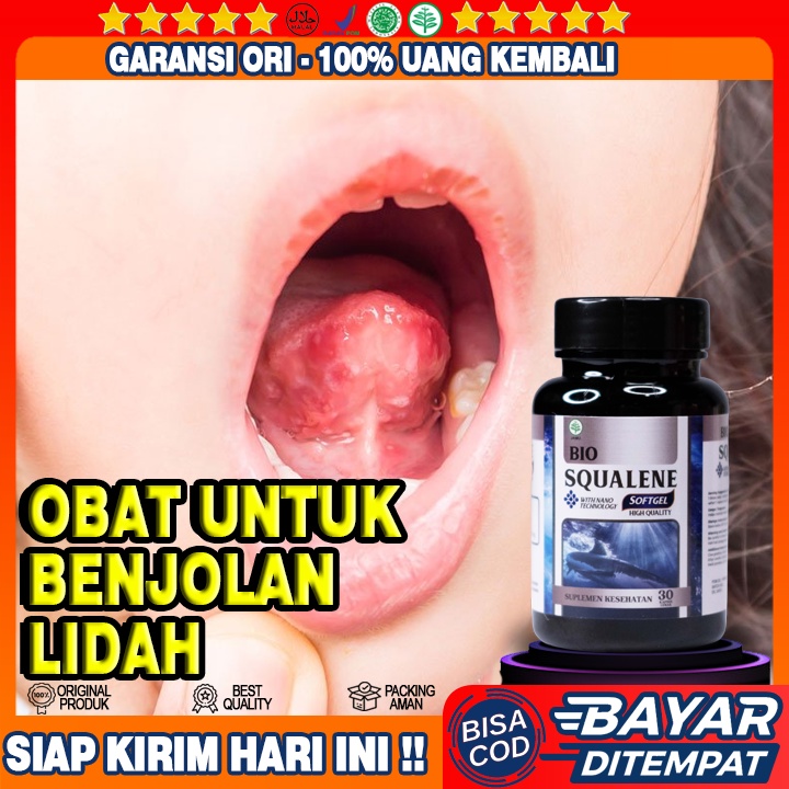 Obat Penghancur Benjolan Di Lidah - Obat Penghilang Benjolan Bawah Lidah - Ujung Lidah - Obat Herbal
