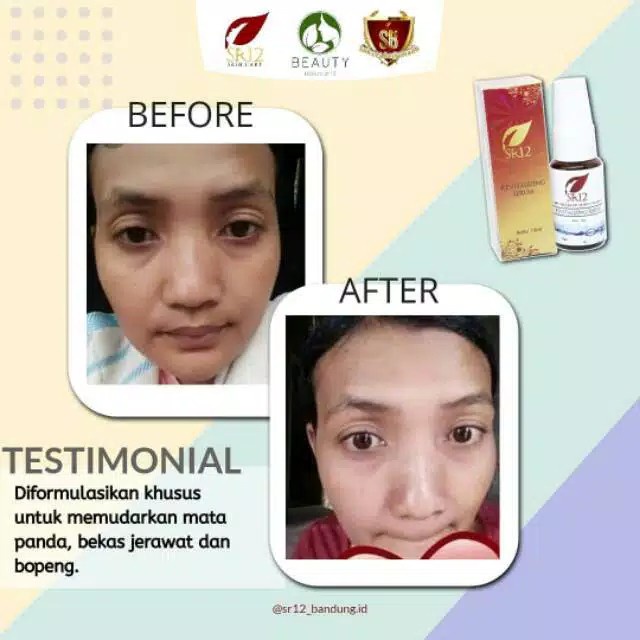 REVITALIZING SERUM SR12 / SERUM MELEMBABKAN &amp; MENCERAHKAN / SERUM BOPENG SERUM MATA PANDA SR12 BPOM