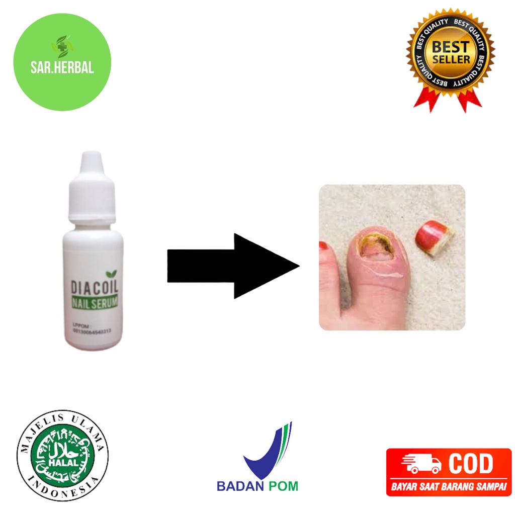DIACOIL SERUM KUKU PENGHILANG CANTENGAN PALING AMPUH