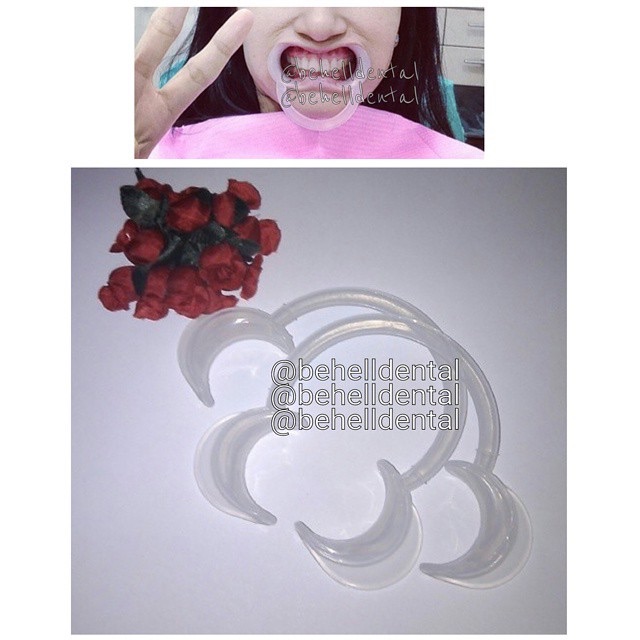 Pembuka Mulut | Dental Cheek Retractor | mouthgate penyangga rahang saat pasang bracket behel/ karet