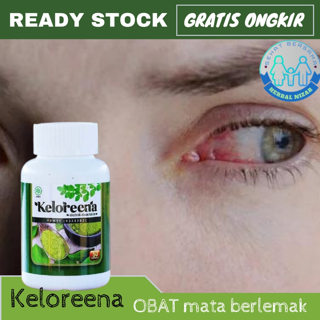 Obat Penghilang Mata Berlemak, Obat Pterigium, Obat Mata Berlemak, Obat Mata Merah Berlemak, Obat Le