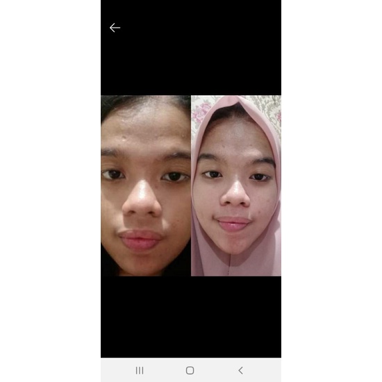 PAKET GLOWING GLOW KRIM PAGI MALAM WHITENING CREAM WAJAH FACE CARE SKINCARE ROUTINE BPOM HALAL AMPUH AMAN TERBAIK TERLARIS DI SHOPEE BEST SELLER ORIGINAL PERAWATAN WAJAH MUKA HALUS MULUS BENING KINCLONG AMPUH REAL TESTI HASIL NYATA KOREAN SKINCARE ORI