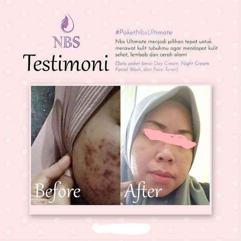 NBS skincare aman BPOM