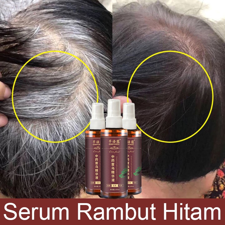 Serum Rambut Hitam Hitam spray 100ml Polygonum Multiflorum Rambut putih alami hingga rambut hitam 100% ekstrak tumbuhan asli Rambut putih tercepat di Indonesia menjadi rambut hitam Rambut hitam permanen Menutrisi Akar Rambut Rambut Putih