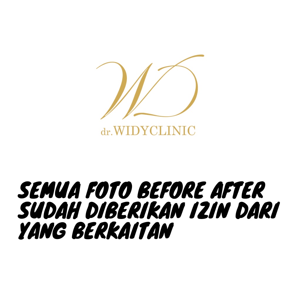 Exclusive Whitening Night Cream dr Widy Clinic Krim Malam Flek, Glowing, Memutihkan, Mencerahkan Wajah Cream Melasma Bekas Jerawat Untuk Semua Jenis Kulit